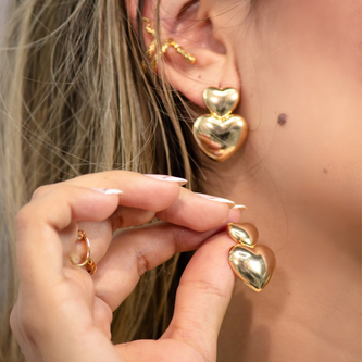 Aretes